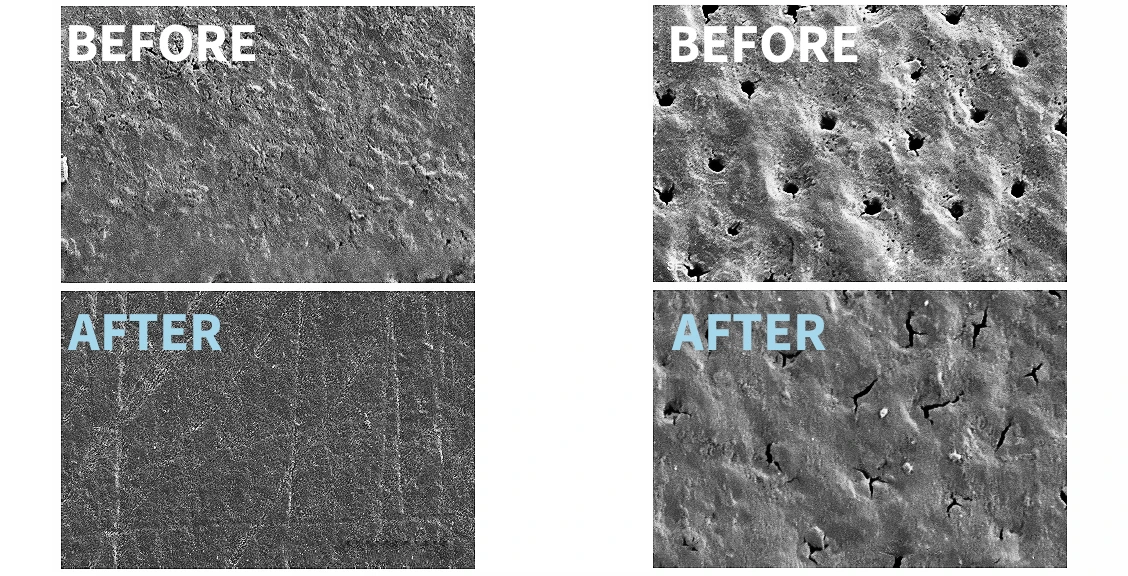 Electron microscope evidence of remineralisation